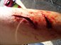 Fresh cut to arm