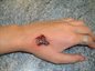 Scab