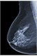 Birmingham Fellow developing new treatment for breast cancer