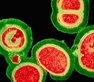 University of Birmingham expert spearheads campaign to boost antibiotic research