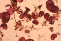 Pollen grains - mainly bi-saccate (conifer) - from surface samples in Turkey. When preserved and recovered from lake sediments and peat deposits pollen analysis is able to inform on vegetation and climate change within the catchment or pollen recruitment