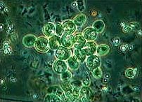 The green alga, Gongrosira incrustans