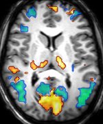 Brain activity measured with functional MRI during sleep (axial slice)
