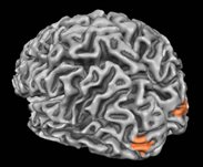 A rendered view of a participant&rsquo;s brain from behind and slightly to the left. The area highlighted is V3B/KO, which is shown by Ban and colleagues to be particularly involved in fusing depth cues to support 3D perception