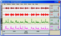Graph representing event related psychophysiology - signals (Image from Biopac website)