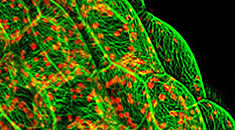 Microtubules