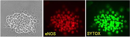 Human fertility research - human Cumulus Oophorus stained for Endothelial NOS
