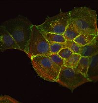 Clump of cells