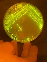Bacteria on an agar plate