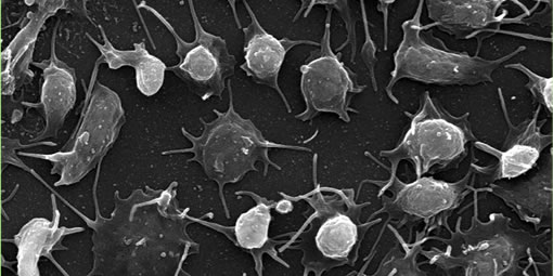 Platelets imaged by scanning electron microscopy