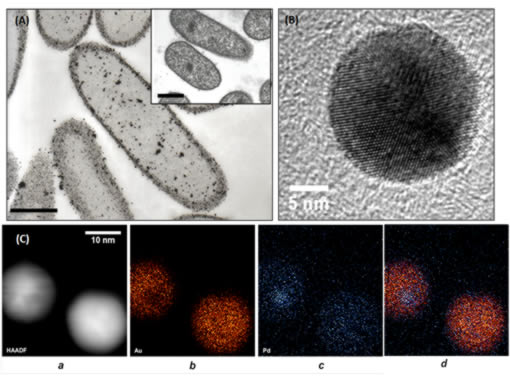 Electron microscopy of metallized E. coli cells