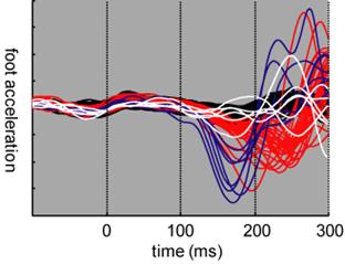 Startle reduces sensorimotor processing time
