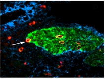Image of fetal thymus colonisation