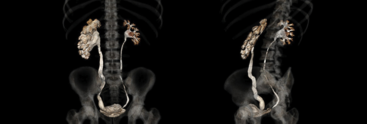New for 2013 – MSc Urology