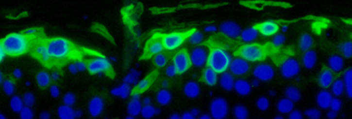 Providing new therapies through world class research