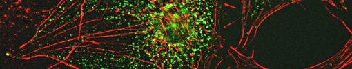 stress fibre formation in cancer cells