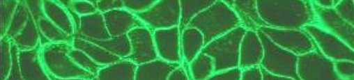 the desmosomal protein desmoplakin in epithelial cells
