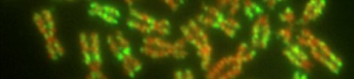 Human metaphase epigenome