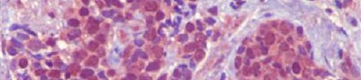 immune cells