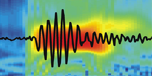 Jefferys-Epilepsy--picture