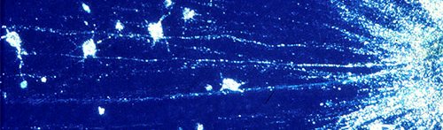 Logan----Neurotrauma--and-Neurodegeneration