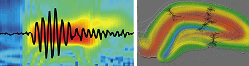 2nd-tier---Epilepsy-and-Neuronal-Networks-picture