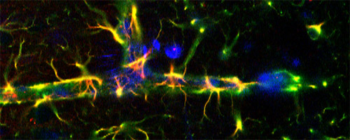 Fulton-glia-v2