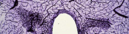 2nd-tier---Neurotrauma-picture