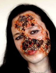 Woman with prosthetic facial burns