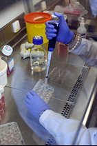 Liver research at University of Birmingham