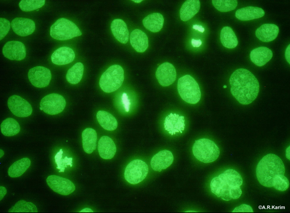 Nuclear with positive metaphase University of Birmingham