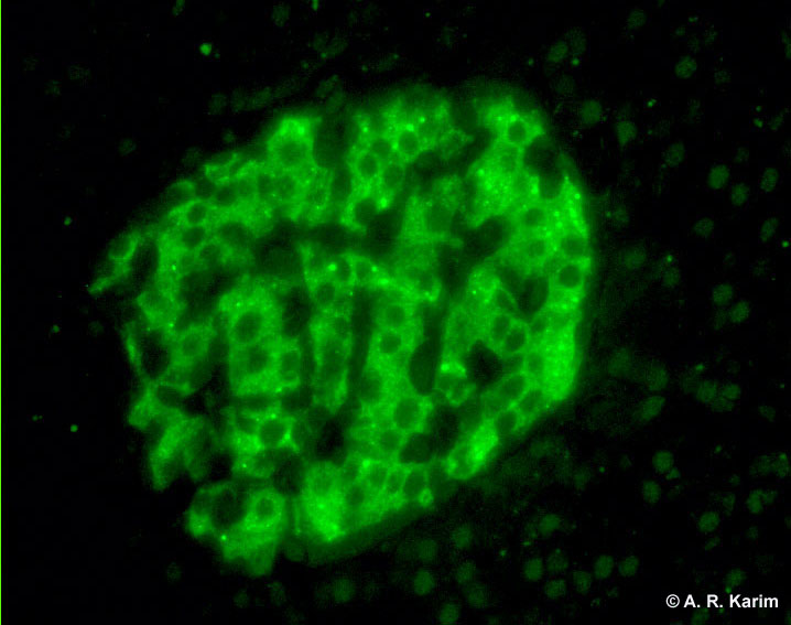 Other neuronal antibodies University of Birmingham