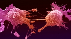 cancer-domain-Cropped-235x130