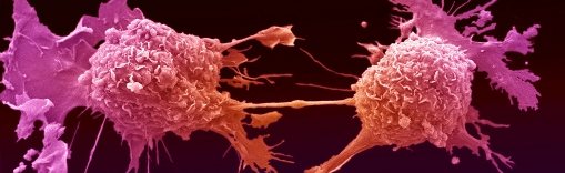 Cancer research at University of Birmingham
