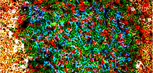 Immunity and infection research at University of Birmingham