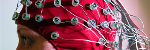 Brain monitoring