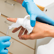 New test to predict sepsis in burns patients