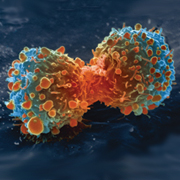 Understanding aggressive cancer cells