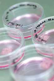 petri-dishes