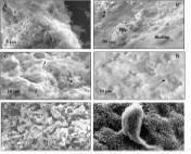 Biofilms