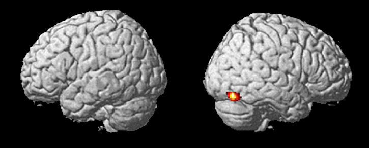 Feature image 2