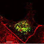 Live cell imaging