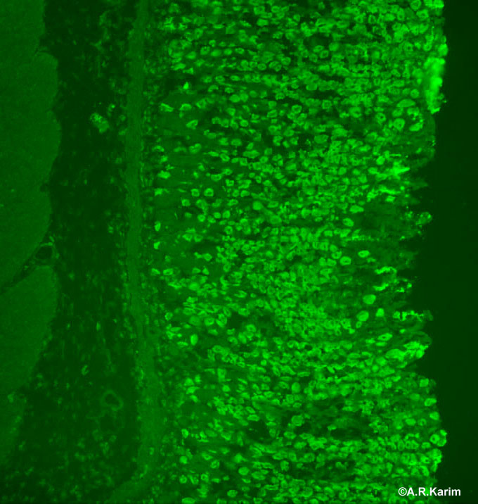 Other Antibodies University of Birmingham