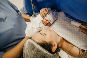 A newborn baby being held next to its mother after a caesarian section birth