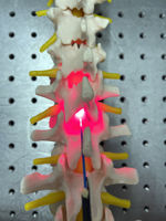 Mock up of device showing positioning in spinal column 