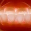 Improving your image: Dental Photography in Practice