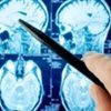 Good Brain, Bad Brain – Parkinson's Disease
