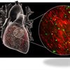 New research to find out what damage diabetes does to the smallest blood vessels of the heart in order to develop new therapies