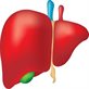 New study explores unique approach to treat a rare liver disease