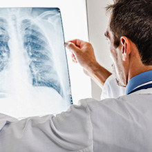 Medical member of staff looking at a lung X-ray